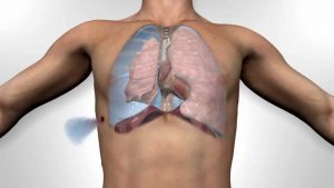 Liệu bệnh lao phổi có nguy hiểm không?